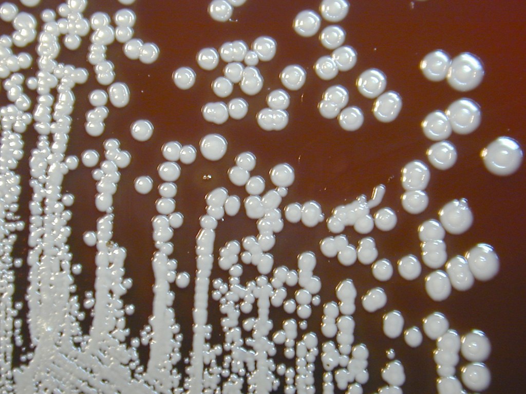 Bacterial colonies of Burkholderia pseudomallei grown on sheep blood agar over a period of 72 hours